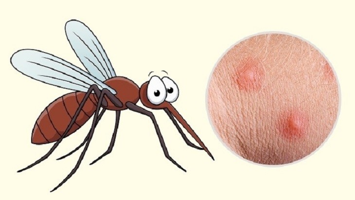 muỗi cắn bị bầm tím